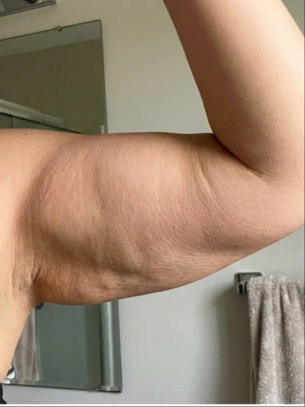 Before - Day 1