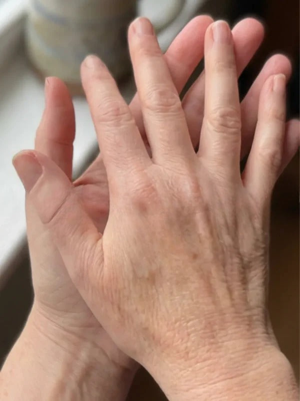 After - Day 45