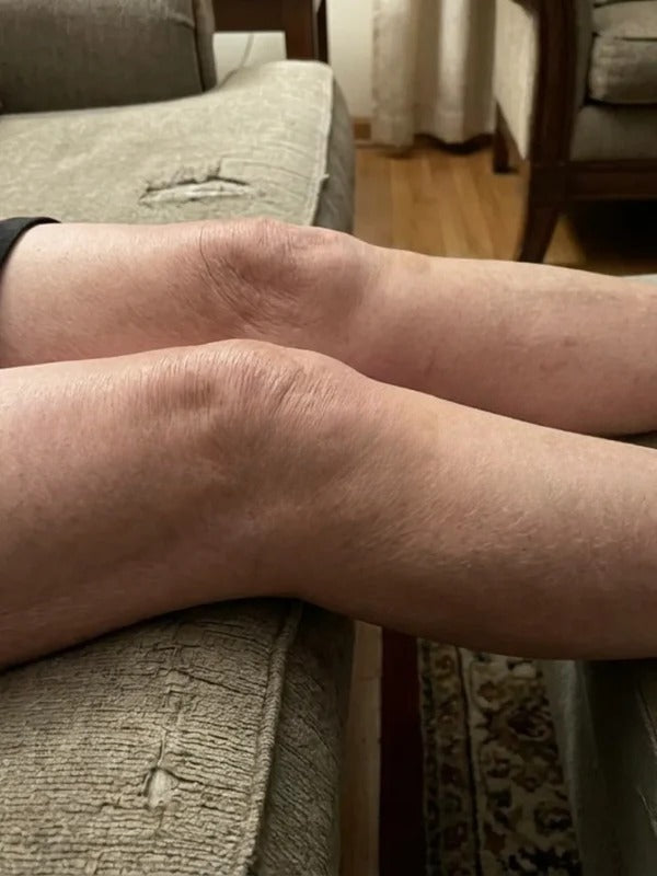 Before - Day 1