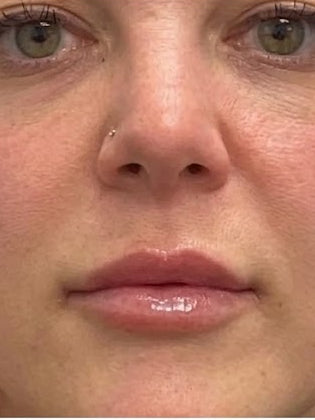 After - Day 60