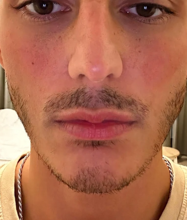 After - Day 60