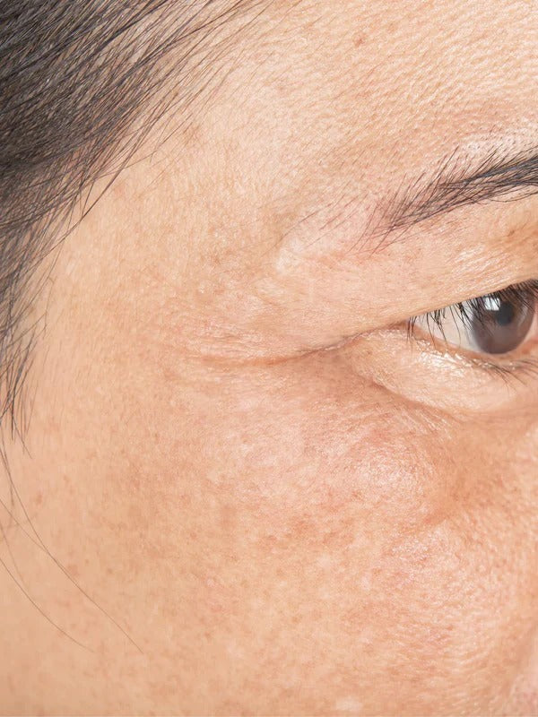 After - Day 30