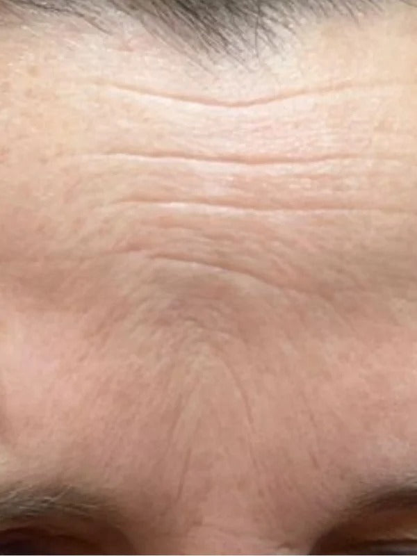After - Day 30