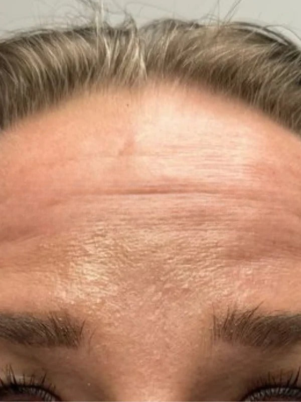 Before - Day 1