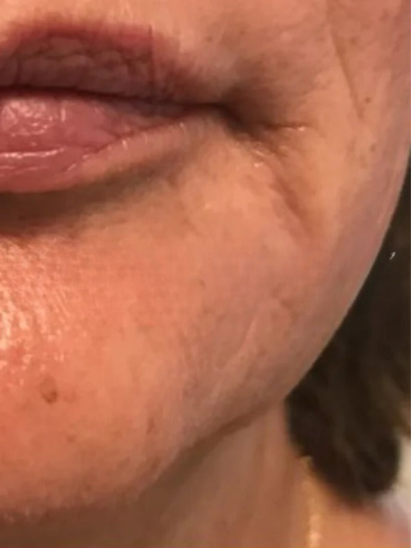 Before - Day 1