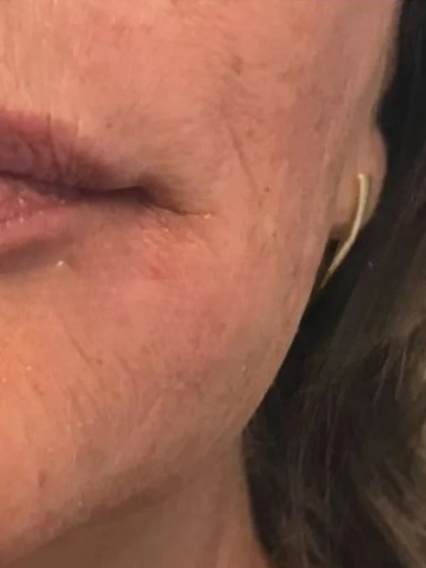 After - Day 60