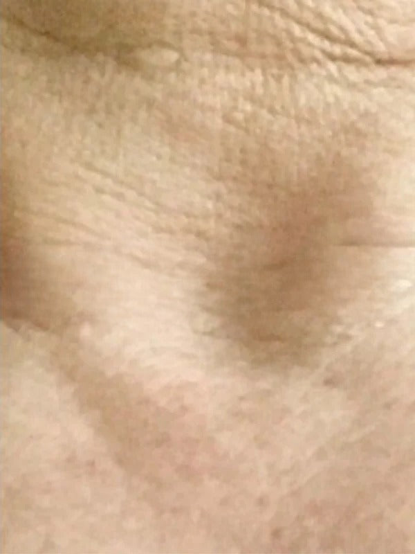 Before - Day 1