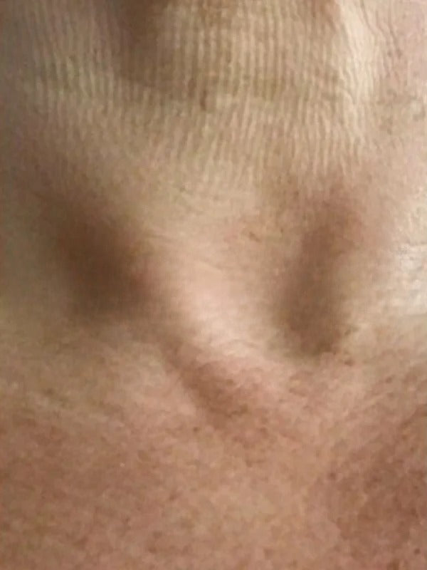 After - Day 60