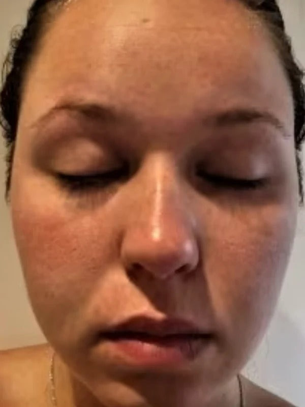 After - Day 30