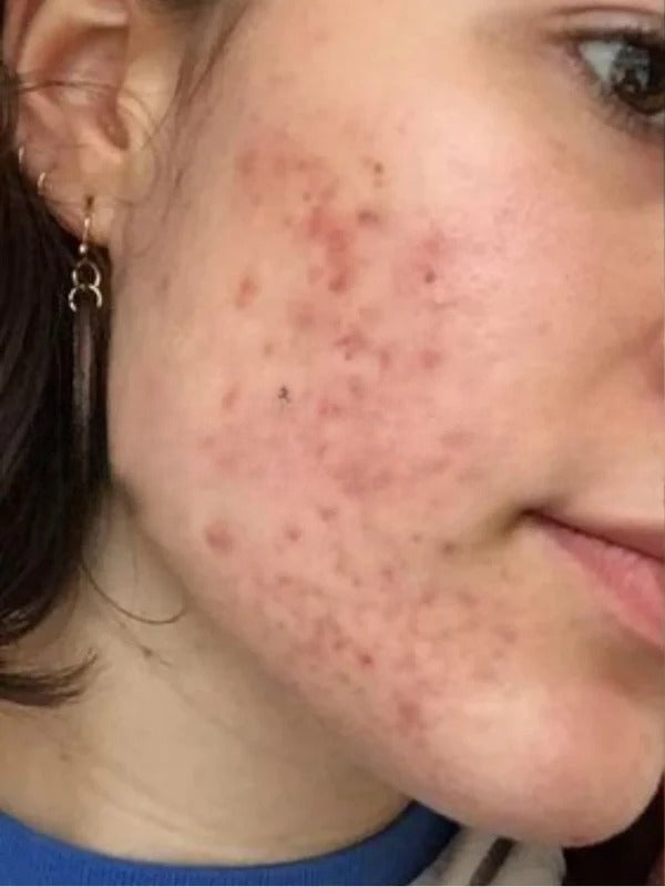 Before - Day 1