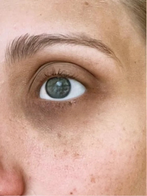 Before - Day 1