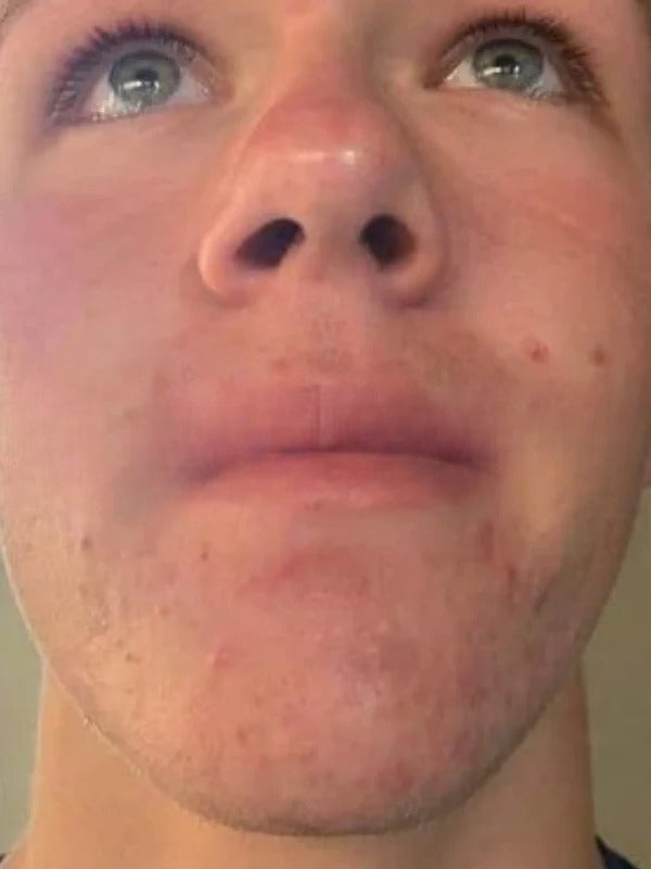 After - Day 60