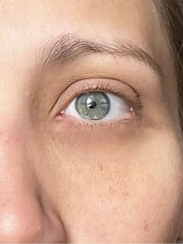 After - Day 30