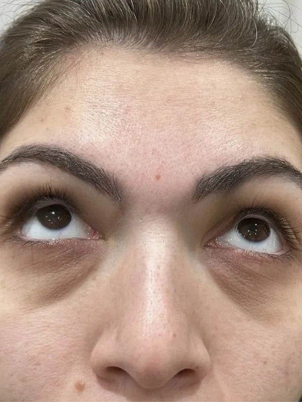 Before - Day 1