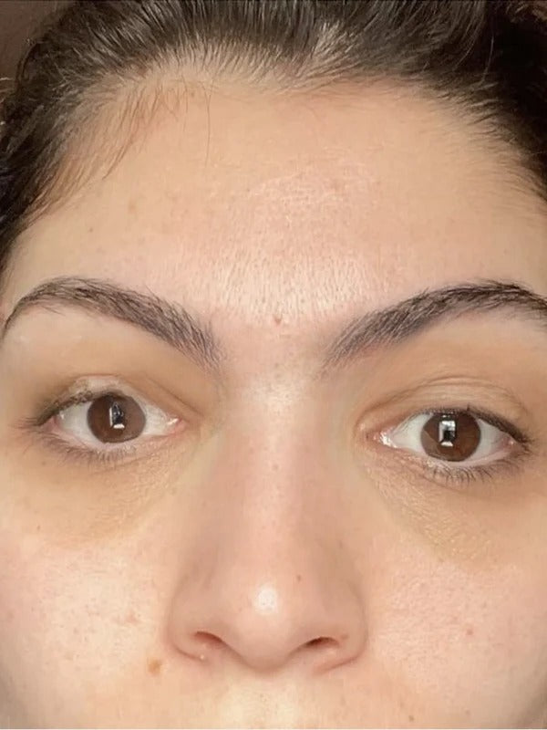 After - Day 45
