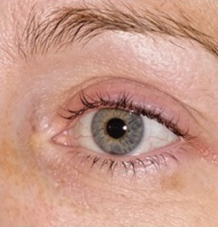 After - Day 30