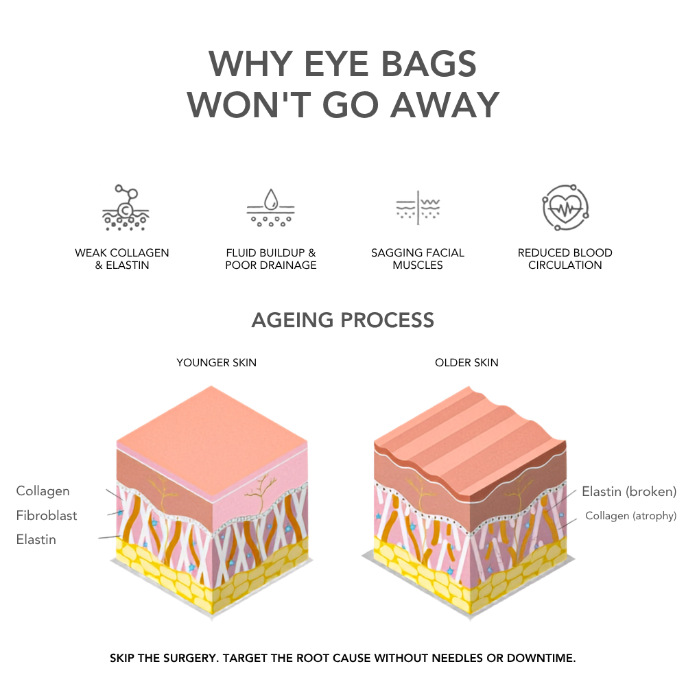 VAURA® 2-in-1 Red Light Therapy + EMS To Erase Eye Bags