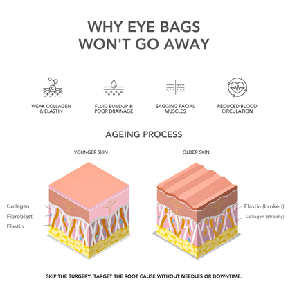 VAURA® 2-in-1 Red Light Therapy + EMS To Erase Eye Bags