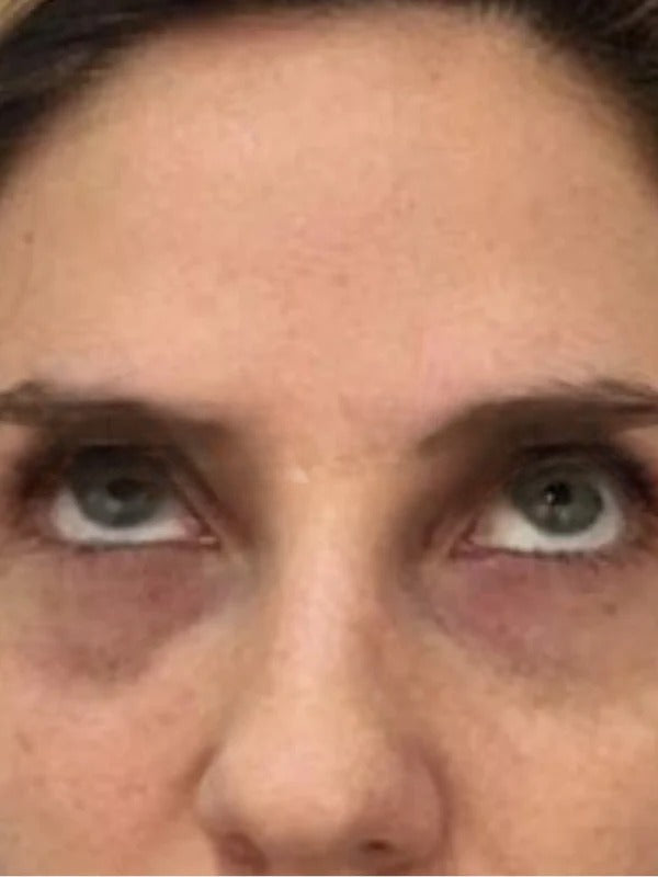 Before - Day 1