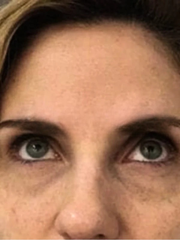 After - Day 60