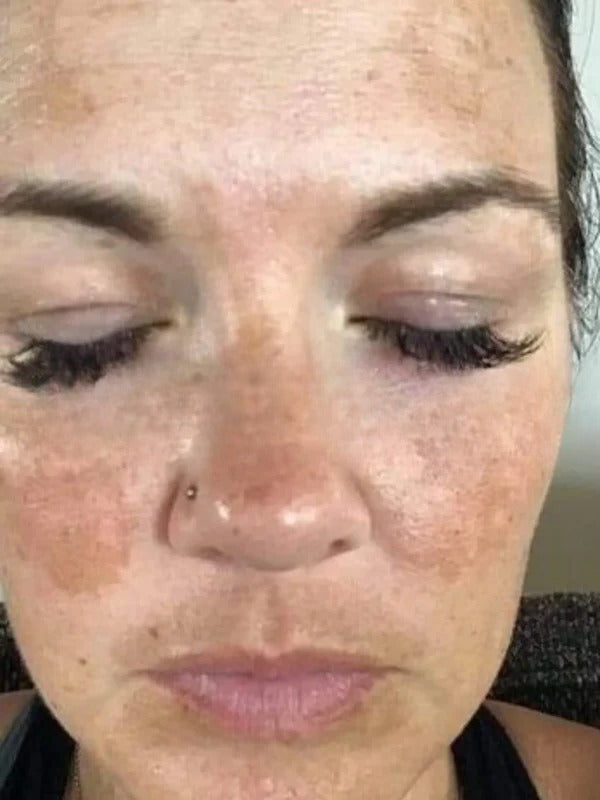 Before - Day 1