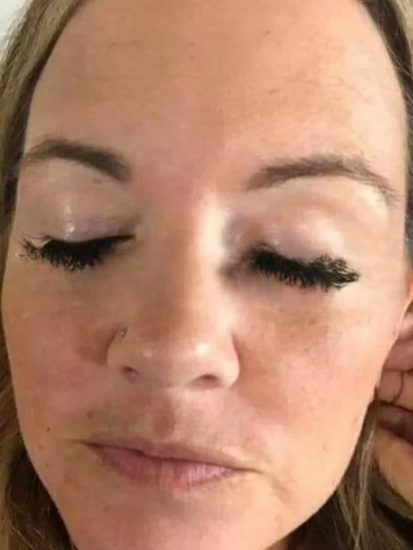 After - Day 30