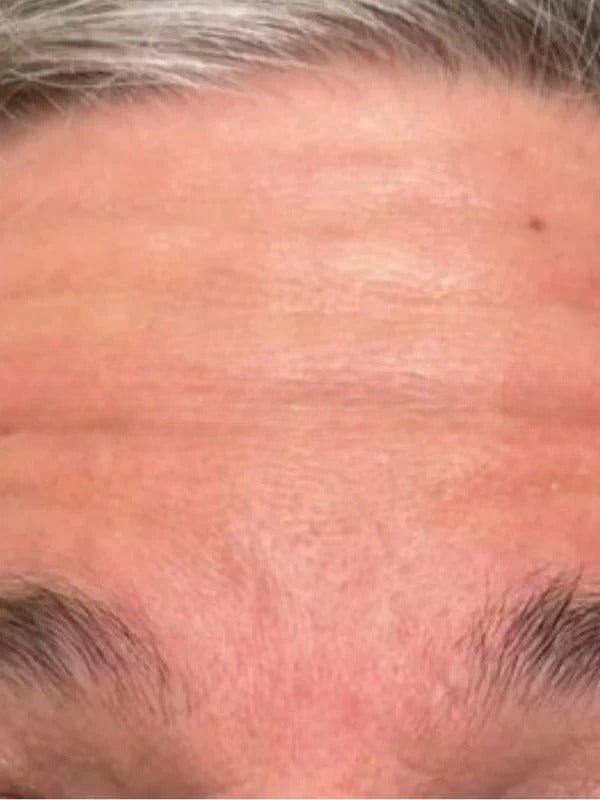 Before - Day 1
